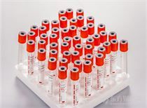 中国生物科技服务附属订立新冠病毒基因工程重组候选疫苗细胞株技术转让协议